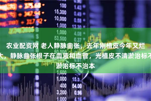 农业配资网 老人静脉曲张，去年刚植皮今年又烂鸡蛋大，静脉曲张根子在血液和血管，光植皮不清淤治标不治本